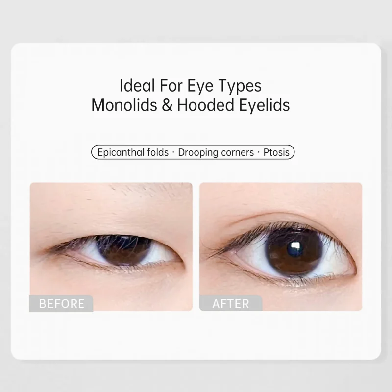 200pcs Oval Shape Eyelid Tape With Applicator & Case- BMS-146 - Image 4