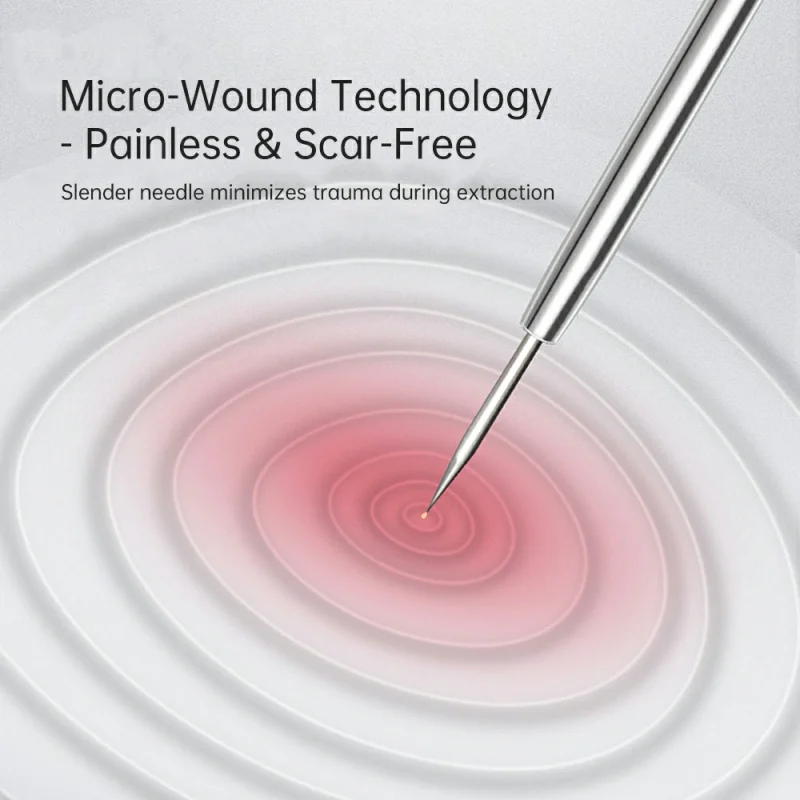 2 in 1 Long & Short Acne-Blackhead-Pimple-Comedone Extraction Kit-BMS-305 - Image 4